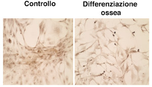 Cellula Staminale Differenziazione ossea