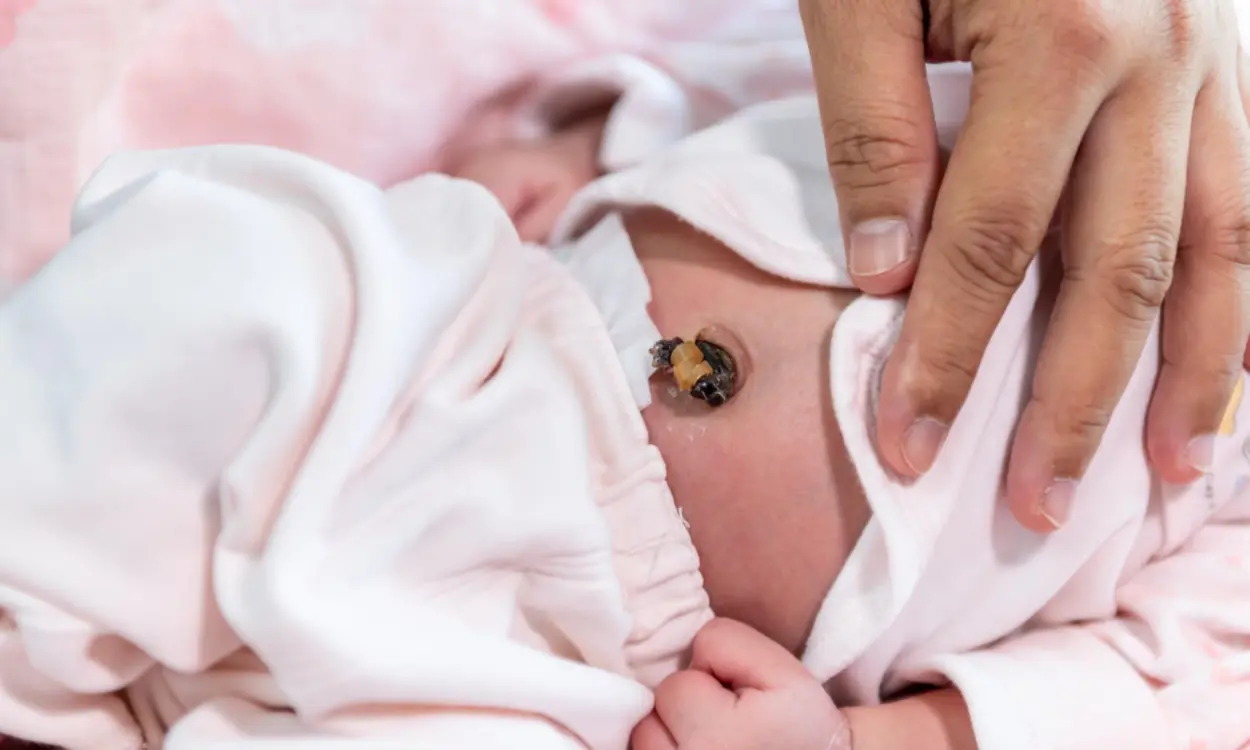 Limiti cordone ombelicale