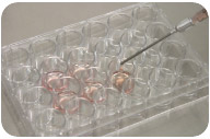 Preparazione del terreno di coltura delle cellule nucleate. Preparazione del terreno di coltura delle cellule nucleate.
